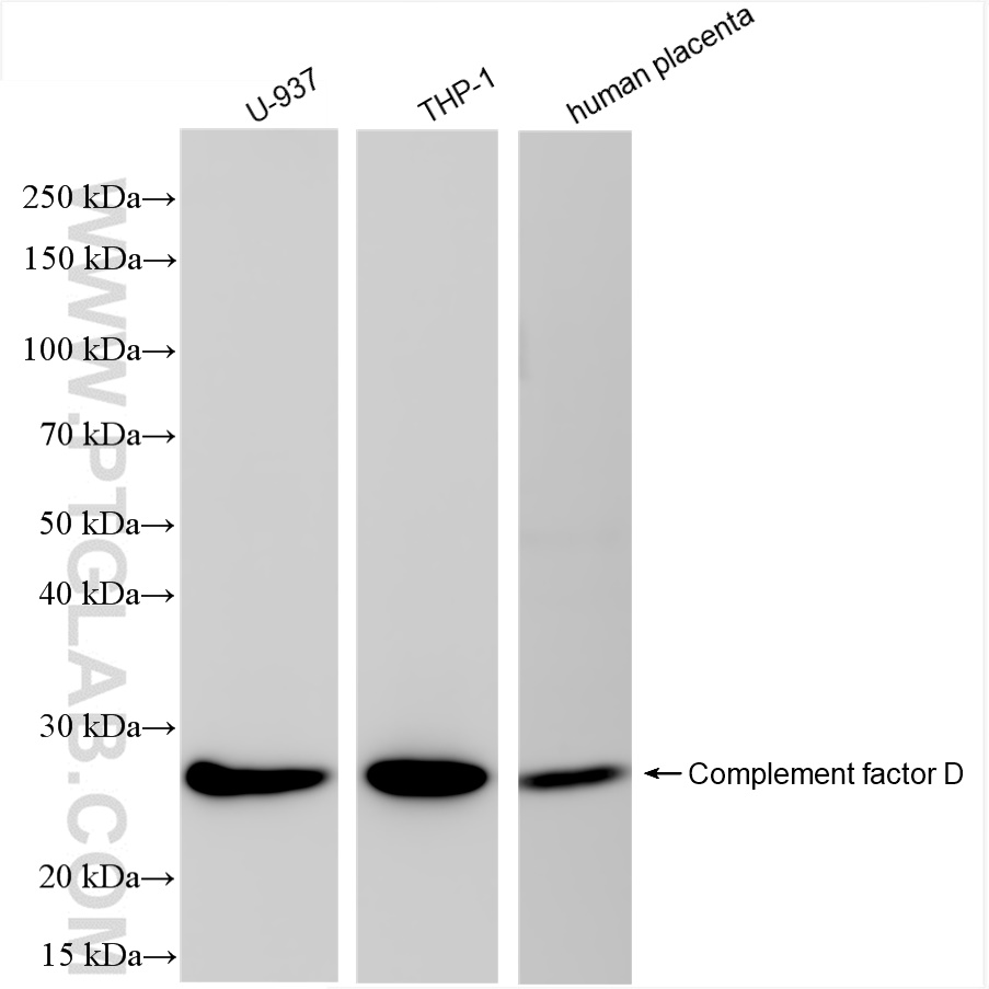 Western Blot (WB) analysis of various lysates using Complement factor D Recombinant antibody (84851-4-RR)