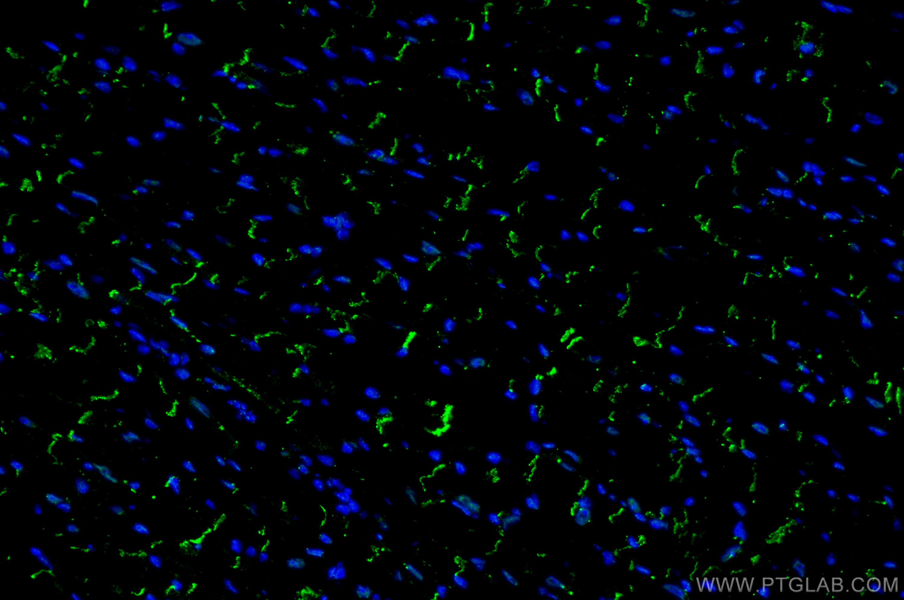 Immunofluorescence (IF) / fluorescent staining of mouse heart tissue using Connexin 43 Polyclonal antibody (26980-1-AP)