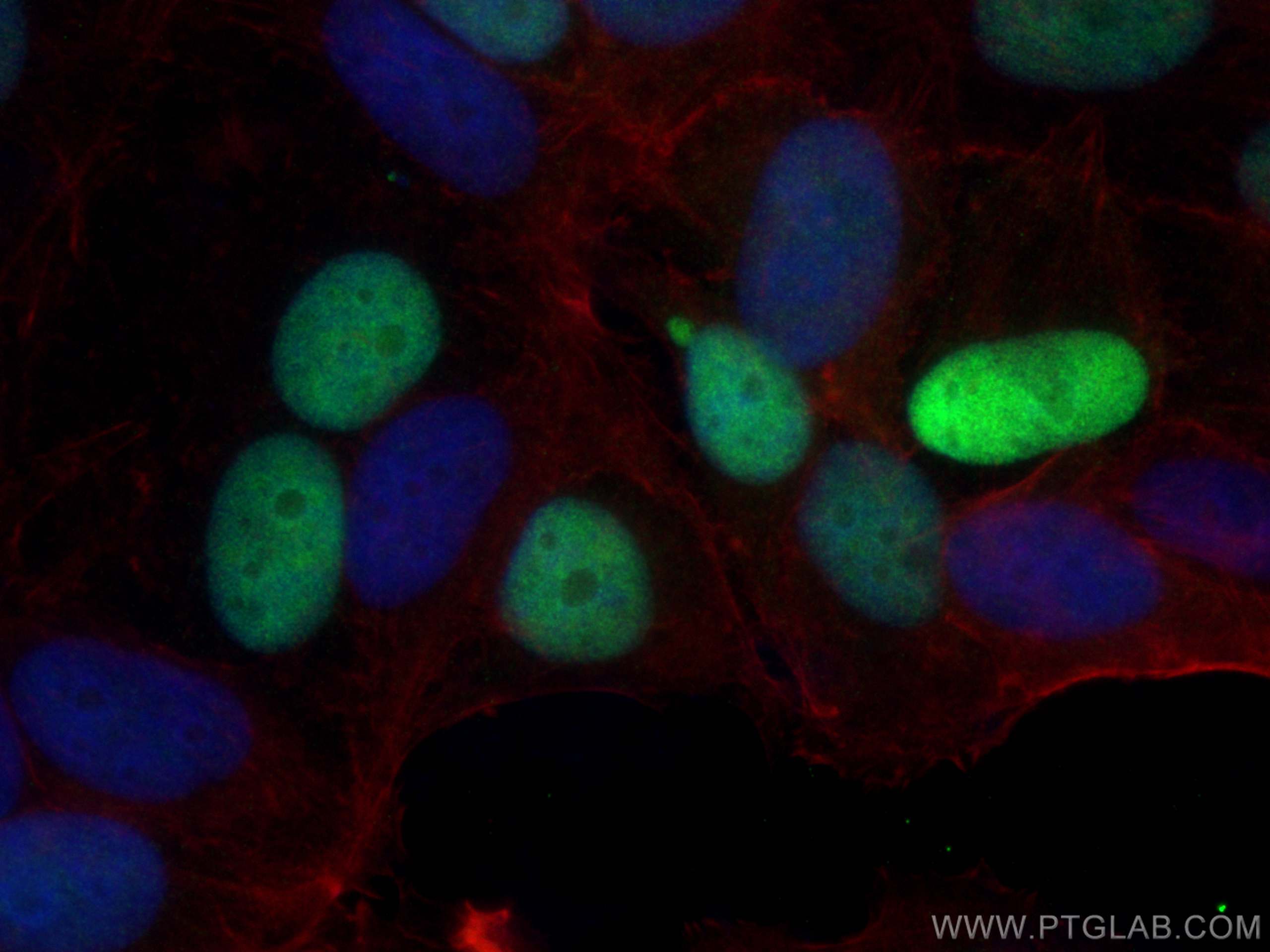 Immunofluorescence (IF) / fluorescent staining of MCF-7 cells using Cyclin D1 Recombinant antibody (82681-1-RR)