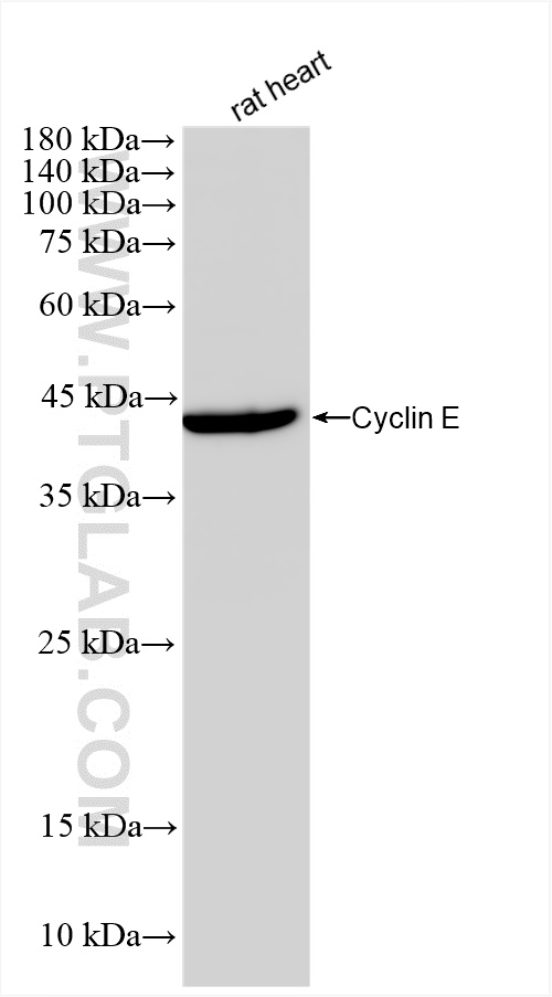 Western Blot (WB) analysis of rat heart tissue using Cyclin E Recombinant antibody (82700-10-RR)