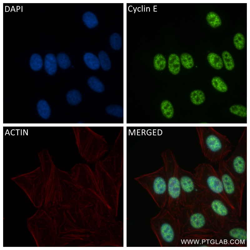 Immunofluorescence (IF) / fluorescent staining of HepG2 cells using Cyclin E1 Recombinant antibody (82700-8-RR)