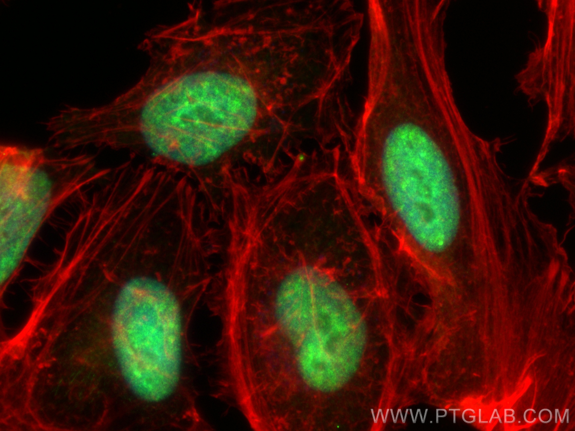 Immunofluorescence (IF) / fluorescent staining of HeLa cells using Cyclin E1 Recombinant antibody (82700-9-RR)