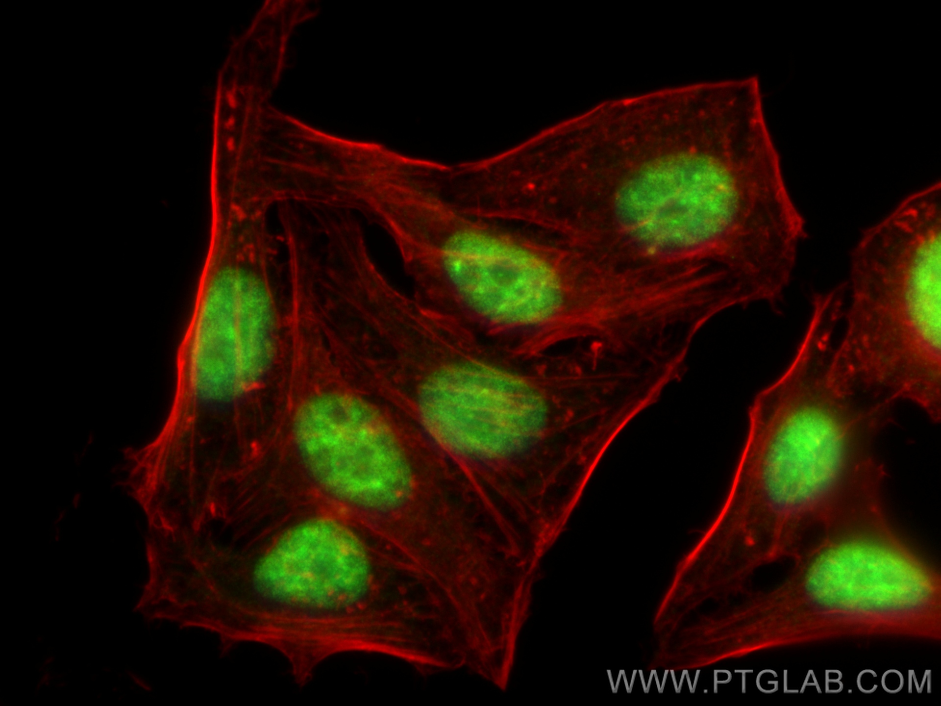 Immunofluorescence (IF) / fluorescent staining of HepG2 cells using Cyclin E1 Recombinant antibody (82700-9-RR)