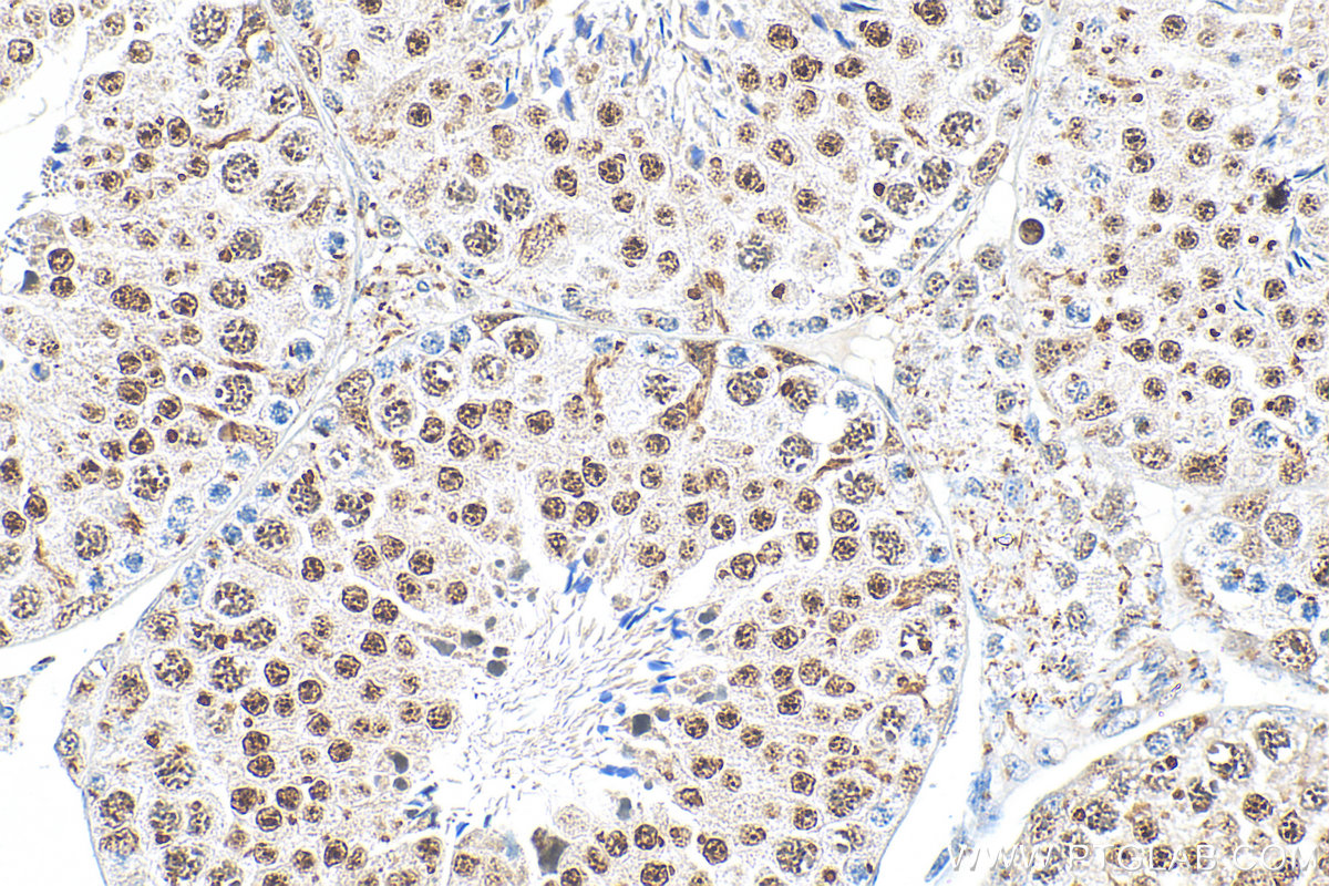 Immunohistochemistry (IHC) staining of mouse testis tissue using Cyclin E1 Recombinant antibody (82700-9-RR)