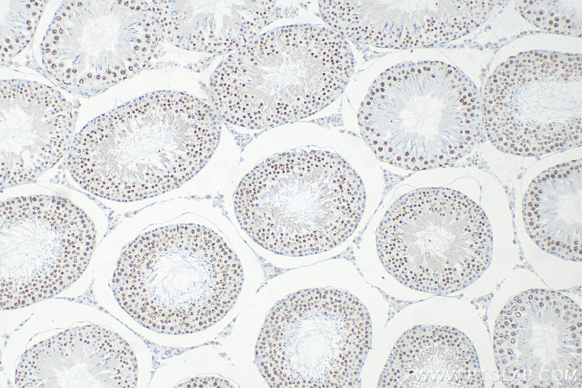 Immunohistochemistry (IHC) staining of rat testis tissue using Cyclin E1 Recombinant antibody (82700-9-RR)