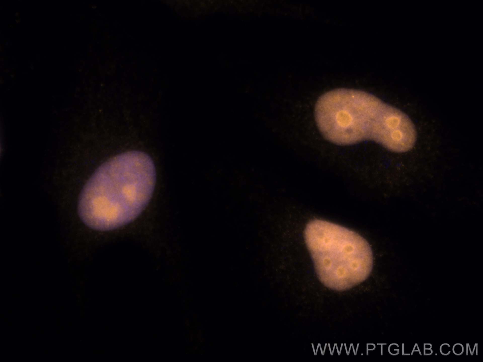 Immunofluorescence (IF) / fluorescent staining of HeLa cells using CoraLite®555-conjugated Cyclin E2 Polyclonal antib (CL555-11935)