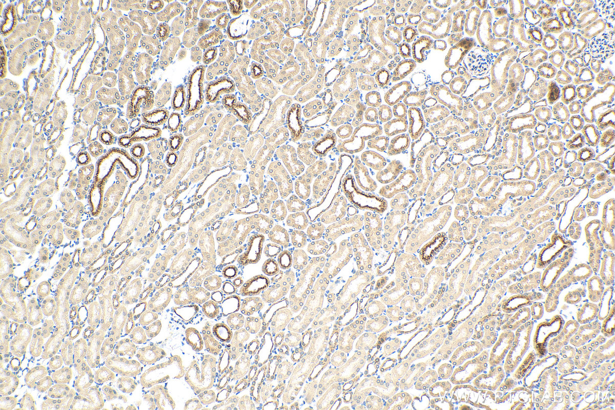 Immunohistochemistry (IHC) staining of mouse kidney tissue using cystatin c Recombinant antibody (83422-1-RR)