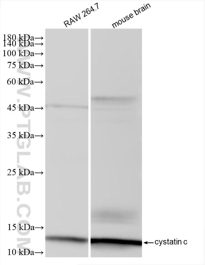 Western Blot (WB) analysis of various lysates using Cystatin C Recombinant antibody (83422-1-RR)