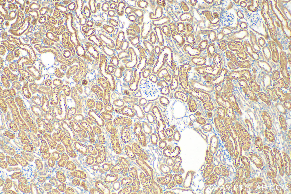 Immunohistochemistry (IHC) staining of mouse kidney tissue using Cytochrome P450 Reductase Polyclonal antibody (29814-1-AP)