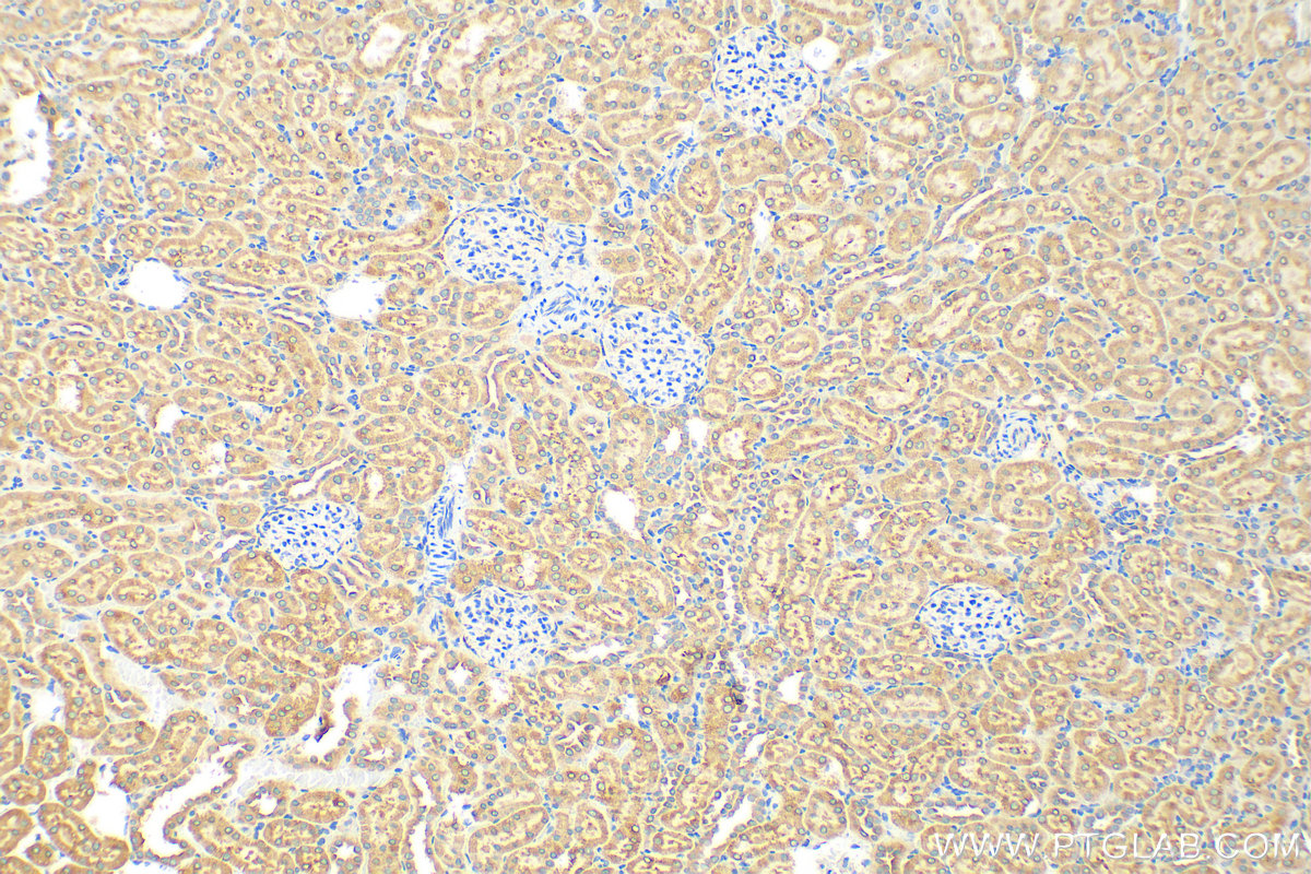 Immunohistochemistry (IHC) staining of rat kidney tissue using Cytochrome P450 Reductase Polyclonal antibody (29814-1-AP)