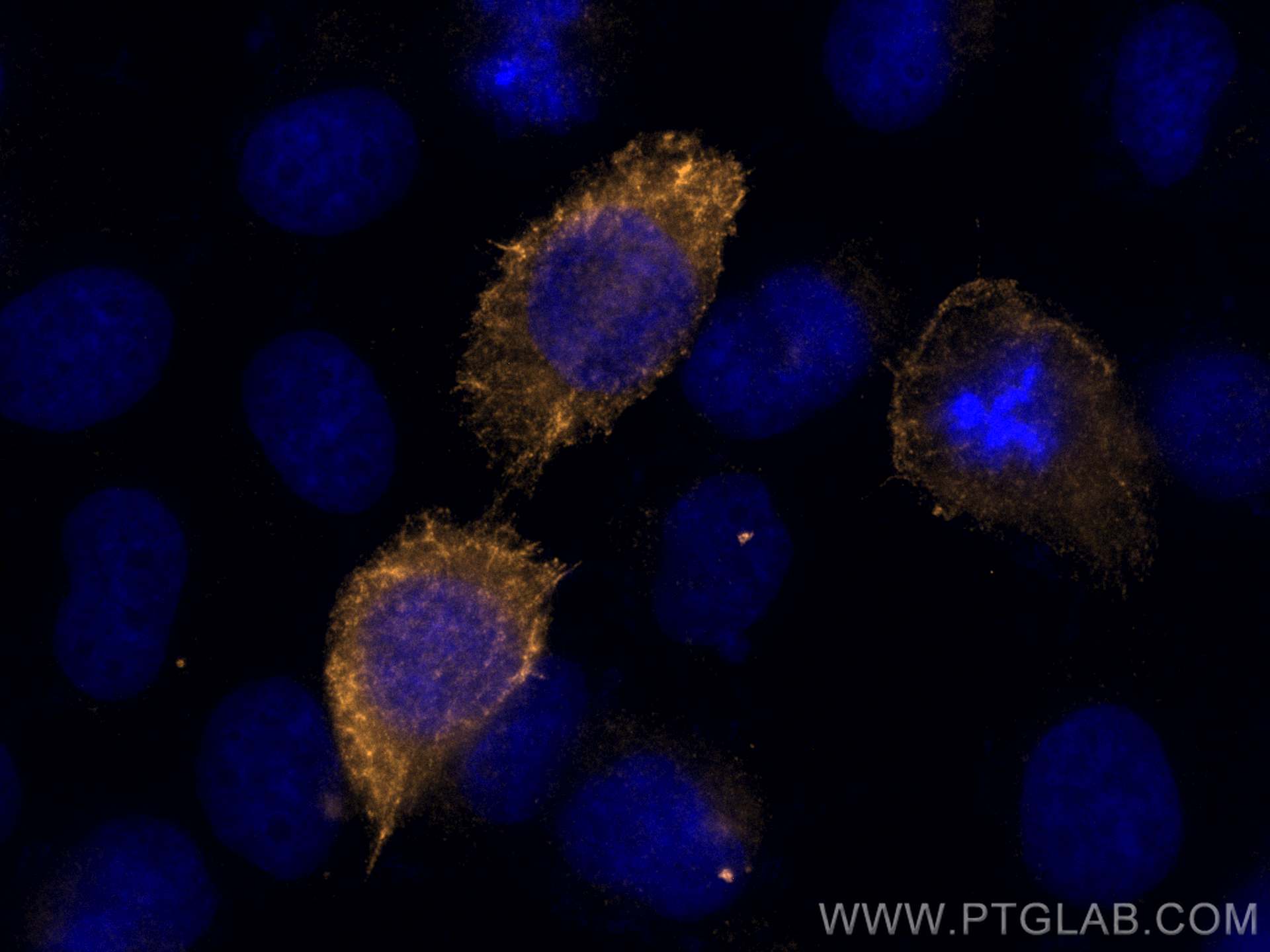 Immunofluorescence (IF) / fluorescent staining of A431 cells using CoraLite® Plus 555-conjugated Cytokeratin 10 Polyc (CL555-18343)