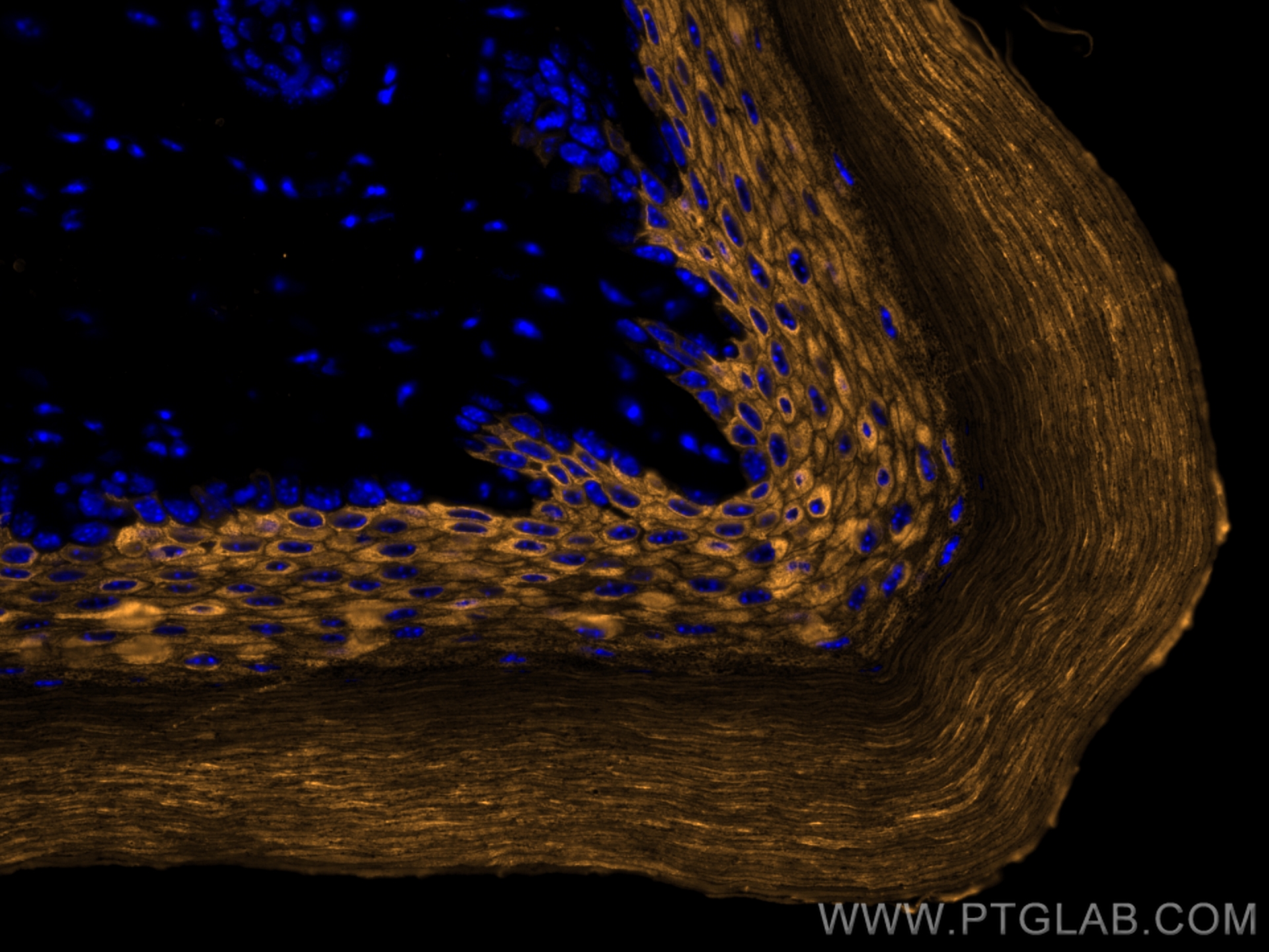 Immunofluorescence (IF) / fluorescent staining of mouse skin tissue using CoraLite® Plus 555-conjugated Cytokeratin 10 Polyc (CL555-18343)