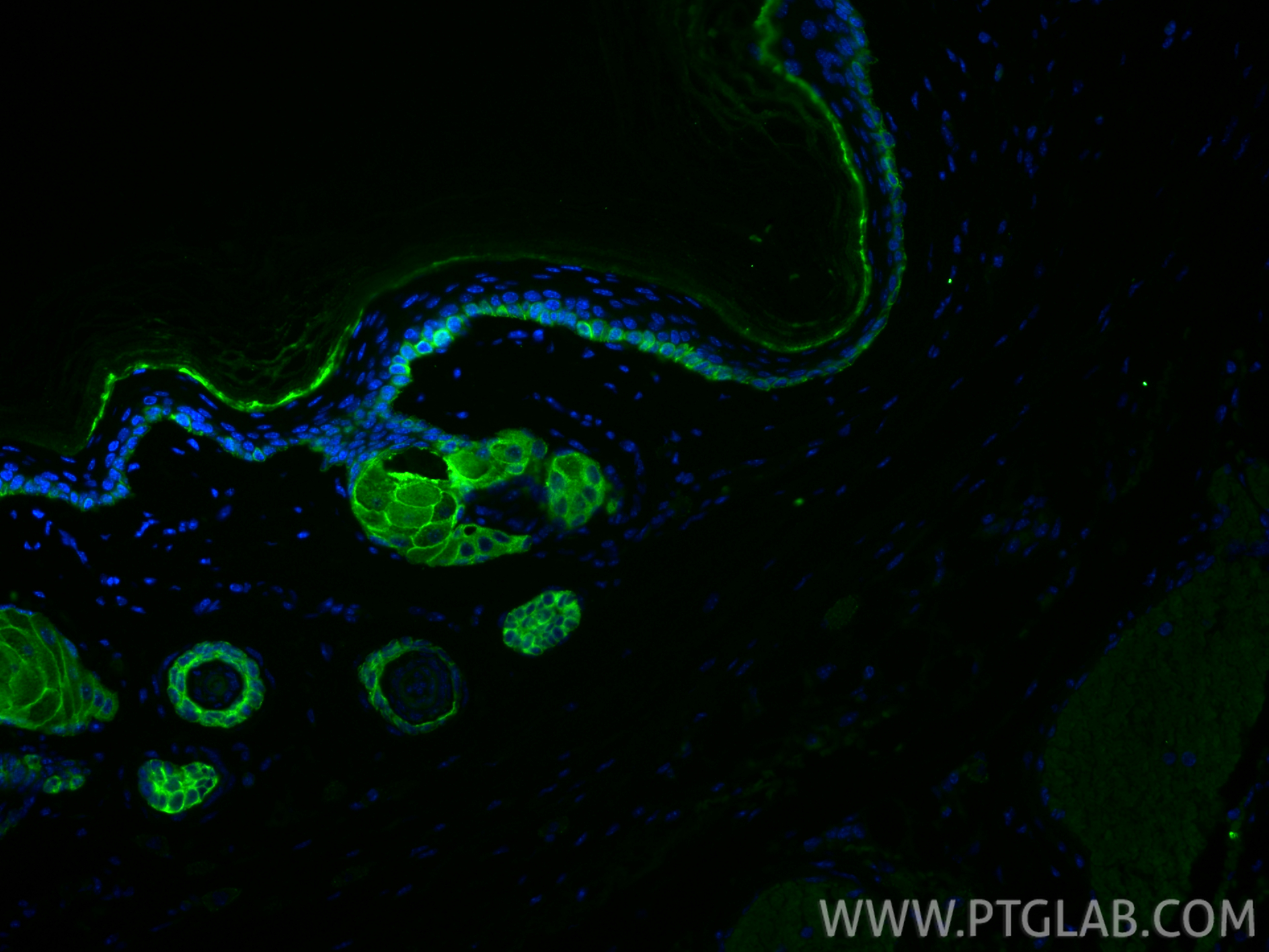 Immunofluorescence (IF) / fluorescent staining of mouse skin tissue using Cytokeratin 13 Recombinant antibody (83058-1-RR)