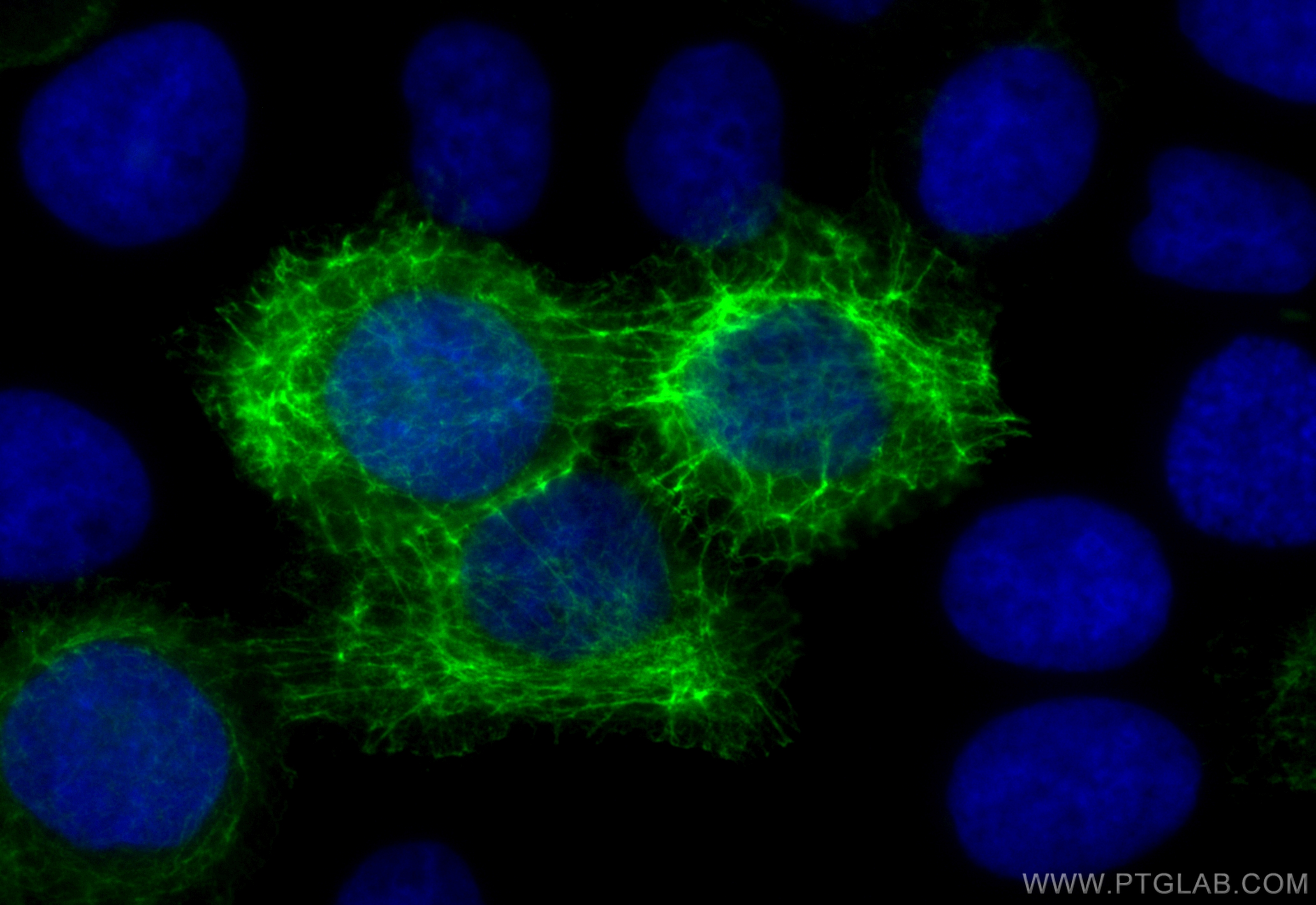 Immunofluorescence (IF) / fluorescent staining of A431 cells using CoraLite® Plus 488-conjugated Cytokeratin 13 Recom (CL488-83058)