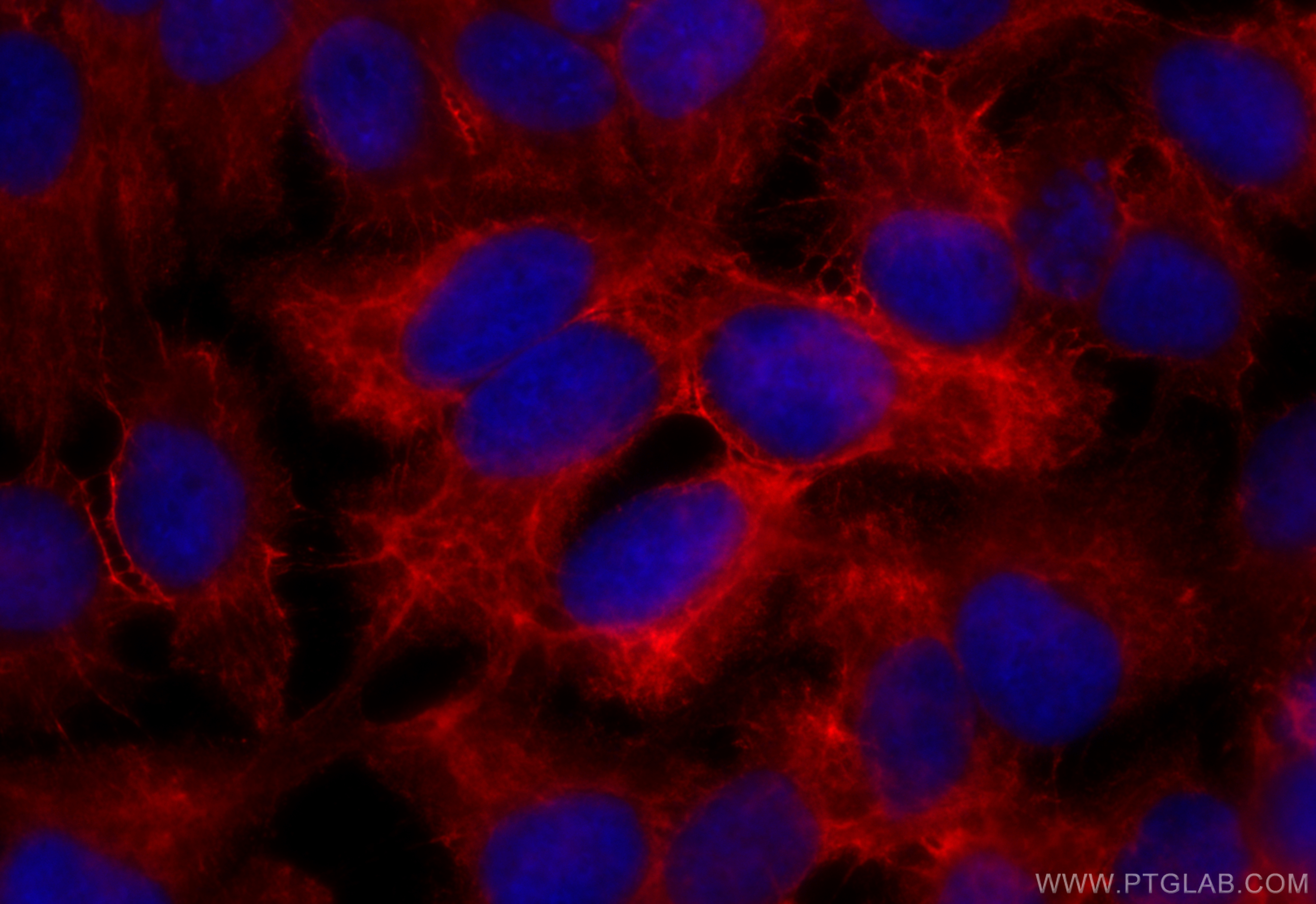 Immunofluorescence (IF) / fluorescent staining of HaCaT cells using CoraLite®594-conjugated Cytokeratin 13 Monoclonal  (CL594-66684)