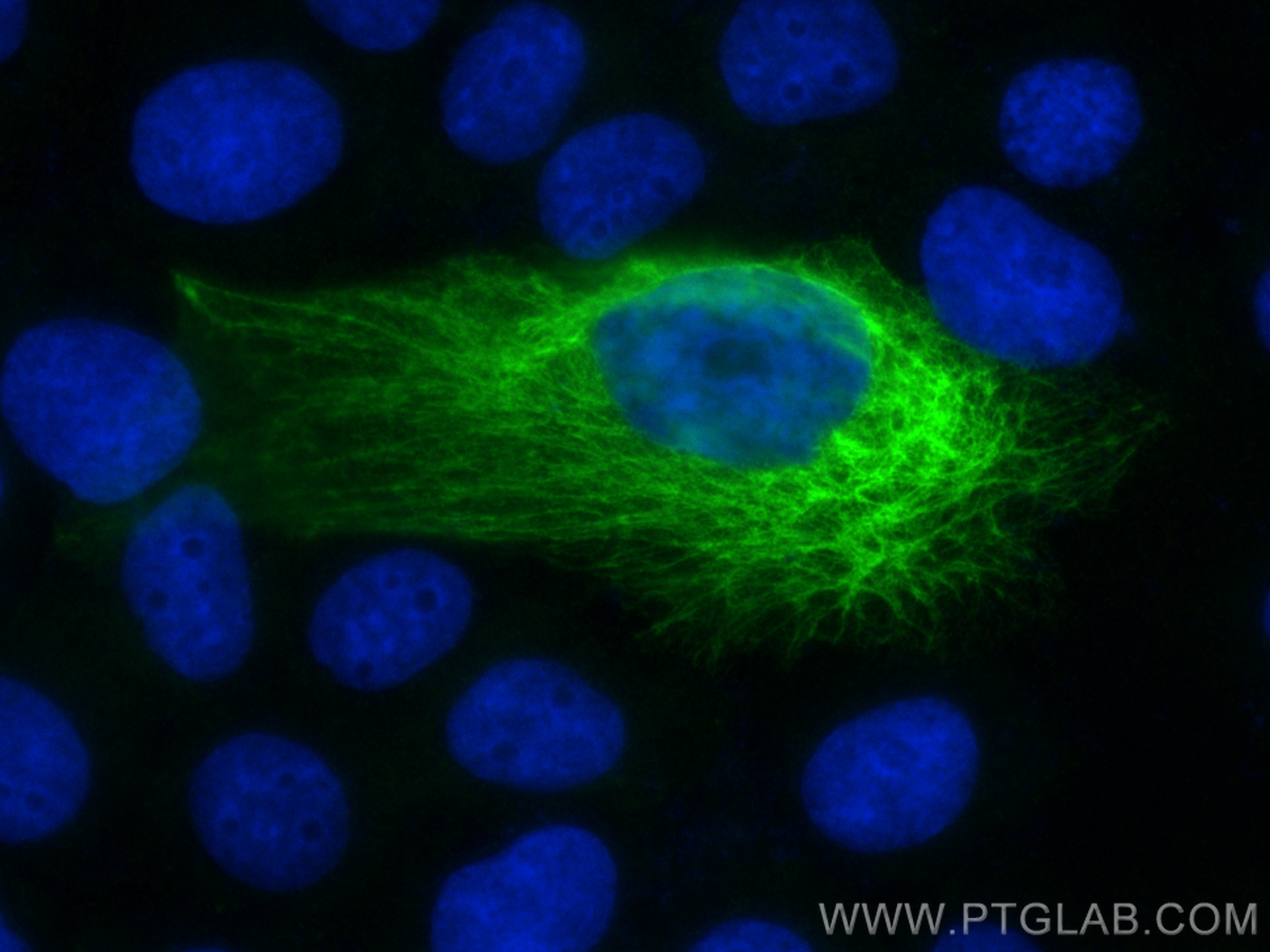 Immunofluorescence (IF) / fluorescent staining of A431 cells using Cytokeratin 14 Recombinant antibody (82824-1-RR)