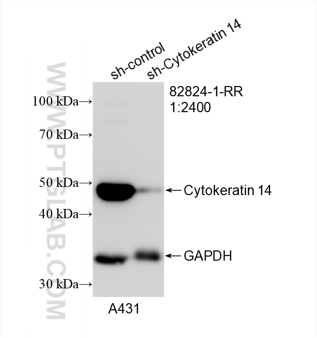 Western Blot (WB) analysis of A431 cells using Cytokeratin 14 Recombinant antibody (82824-1-RR)