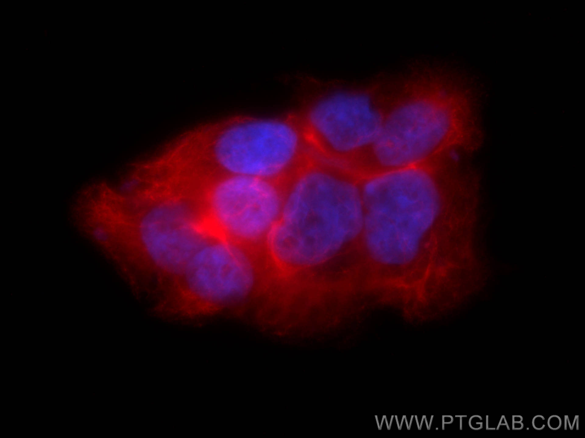 Immunofluorescence (IF) / fluorescent staining of HaCaT cells using CoraLite®594-conjugated Cytokeratin 14 Polyclonal  (CL594-10143)
