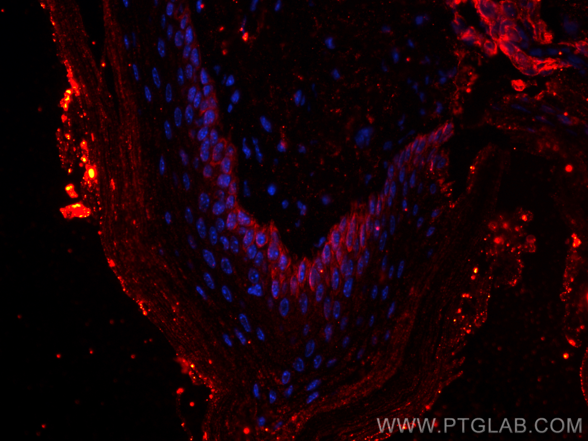 Immunofluorescence (IF) / fluorescent staining of mouse skin tissue using CoraLite®594-conjugated Cytokeratin 14 Monoclonal  (CL594-60320)