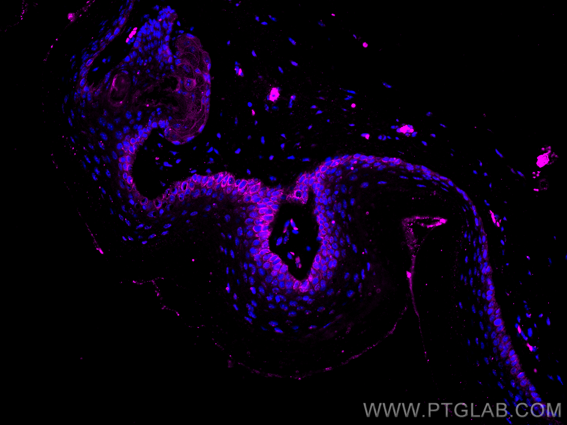 Immunofluorescence (IF) / fluorescent staining of mouse skin tissue using CoraLite® Plus 647-conjugated Cytokeratin 14 Monoc (CL647-60320)