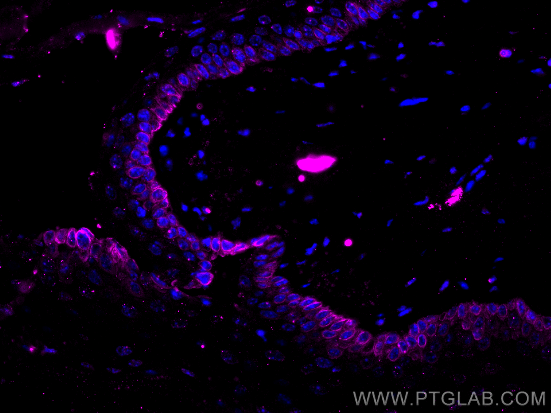 Immunofluorescence (IF) / fluorescent staining of mouse skin tissue using CoraLite® Plus 647-conjugated Cytokeratin 14 Monoc (CL647-60320)