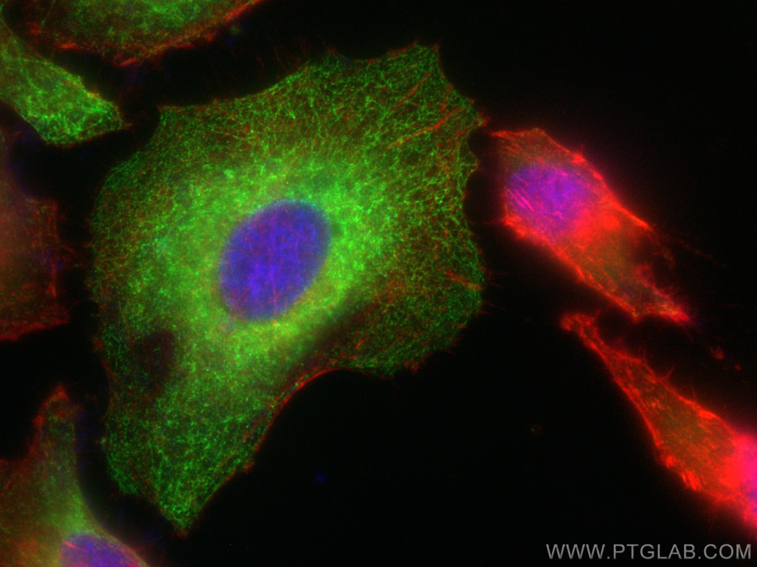 Immunofluorescence (IF) / fluorescent staining of HeLa cells using CoraLite® Plus 488-conjugated Cytokeratin 15 Monoc (CL488-60247)