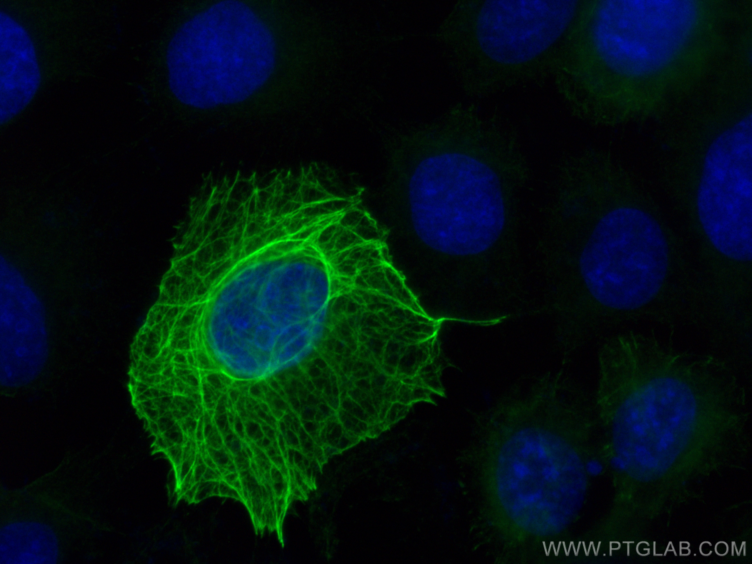 Immunofluorescence (IF) / fluorescent staining of A431 cells using CoraLite® Plus 488-conjugated Cytokeratin 16 Polyc (CL488-17265)
