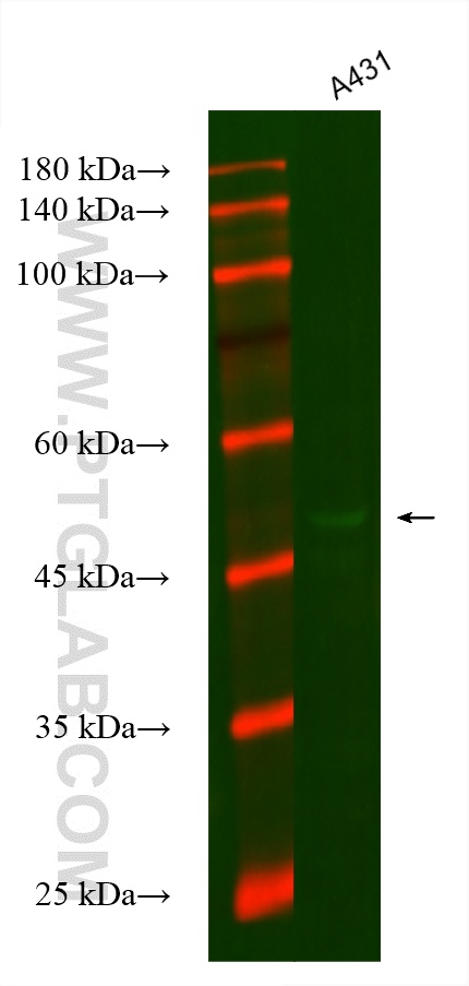 Western Blot (WB) analysis of various lysates using CoraLite® Plus 488-conjugated Cytokeratin 16 Monoc (CL488-66802)