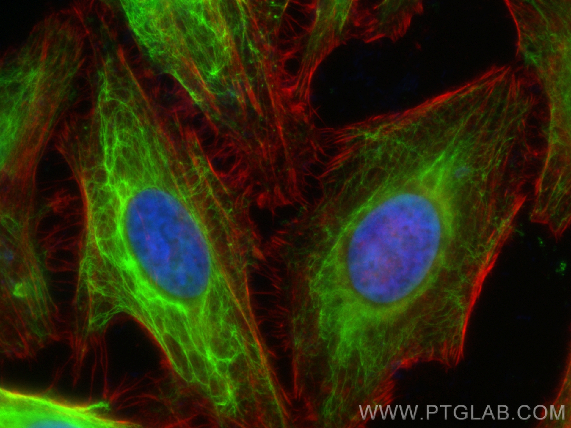Immunofluorescence (IF) / fluorescent staining of HeLa cells using CoraLite® Plus 488-conjugated Cytokeratin 17 Polyc (CL488-18502)