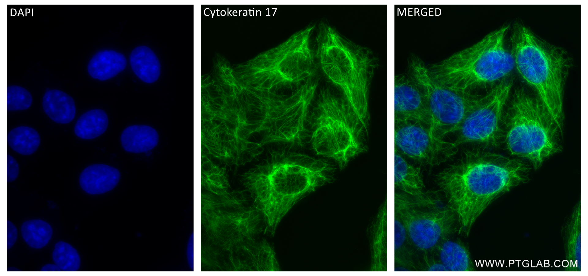 Immunofluorescence (IF) / fluorescent staining of HeLa cells using Cytokeratin 17-Specific Recombinant antibody (84978-1-RR)