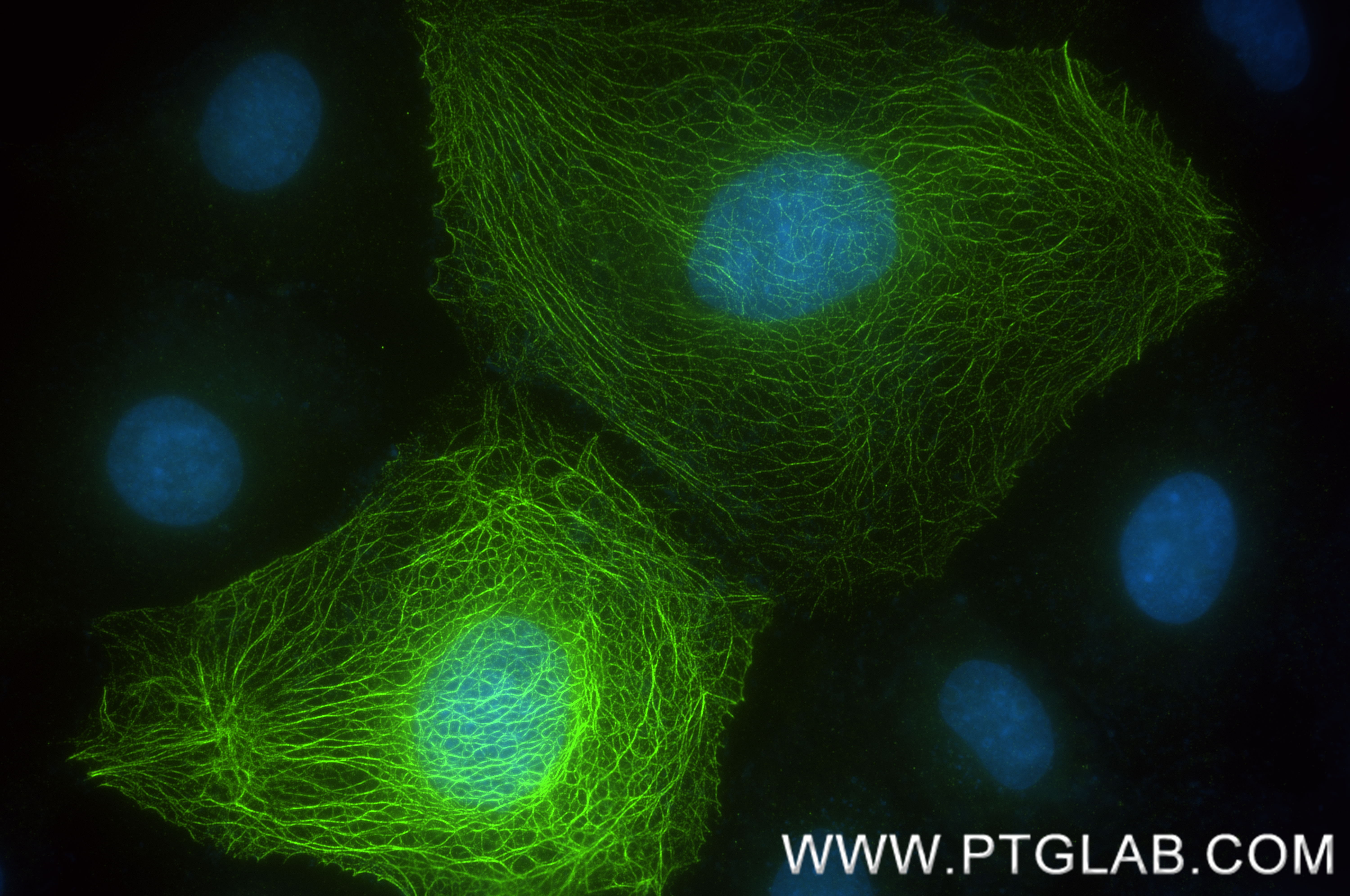 Immunofluorescence (IF) / fluorescent staining of A431 cells using Cytokeratin 17-Specific Recombinant antibody (84978-1-RR)