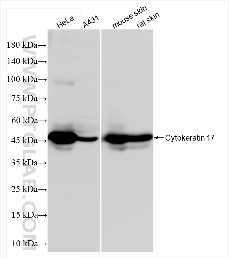 Western Blot (WB) analysis of various lysates using Cytokeratin 17-Specific Recombinant antibody (84978-1-RR)