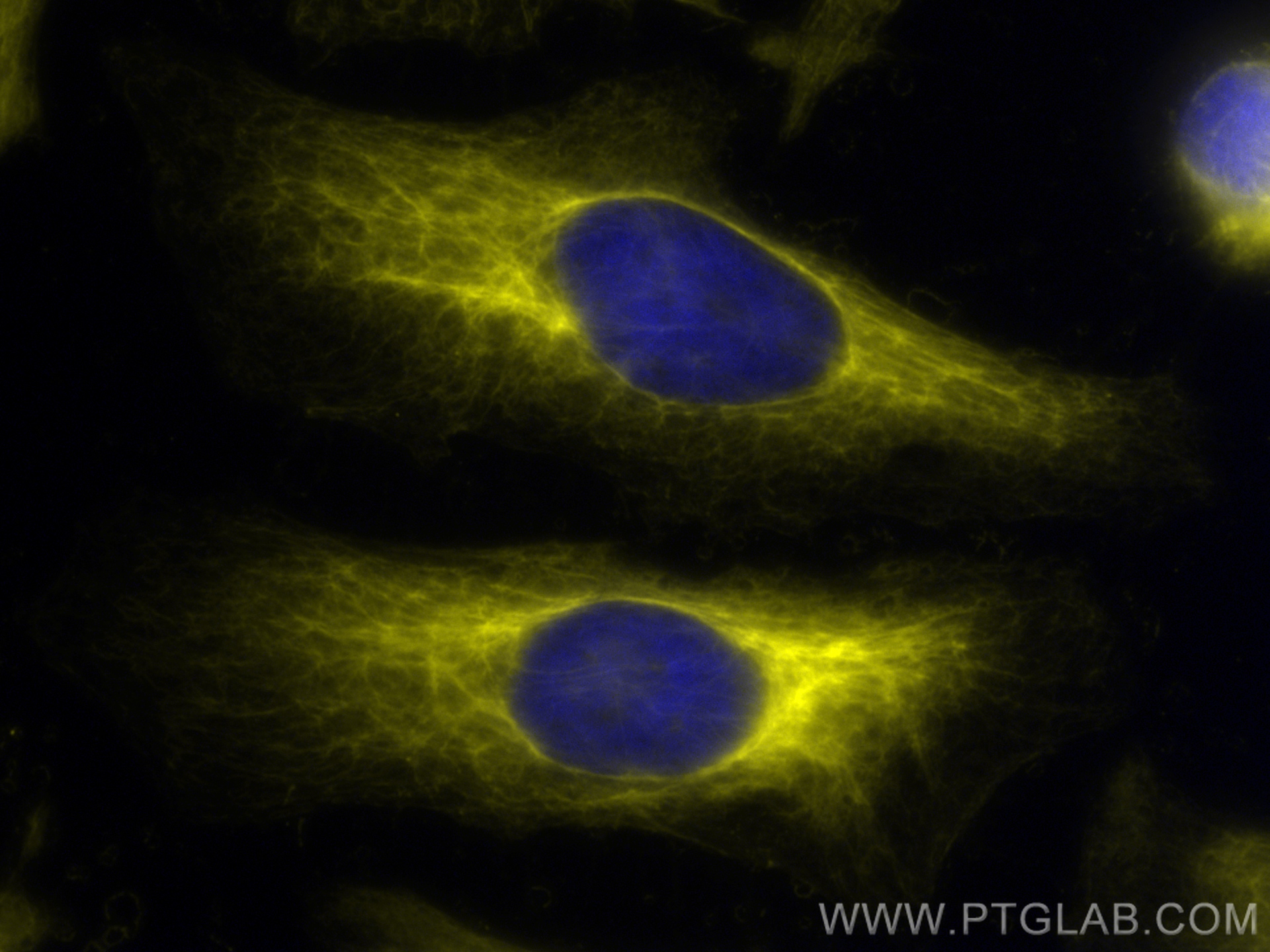 Immunofluorescence (IF) / fluorescent staining of HeLa cells using CoraLite®532-conjugated Cytokeratin 18 Monoclonal  (CL532-66187)