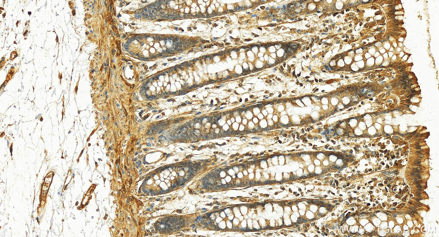 Immunohistochemistry (IHC) staining of human normal colon using Cytokeratin 19 Polyclonal antibody (29855-1-AP)