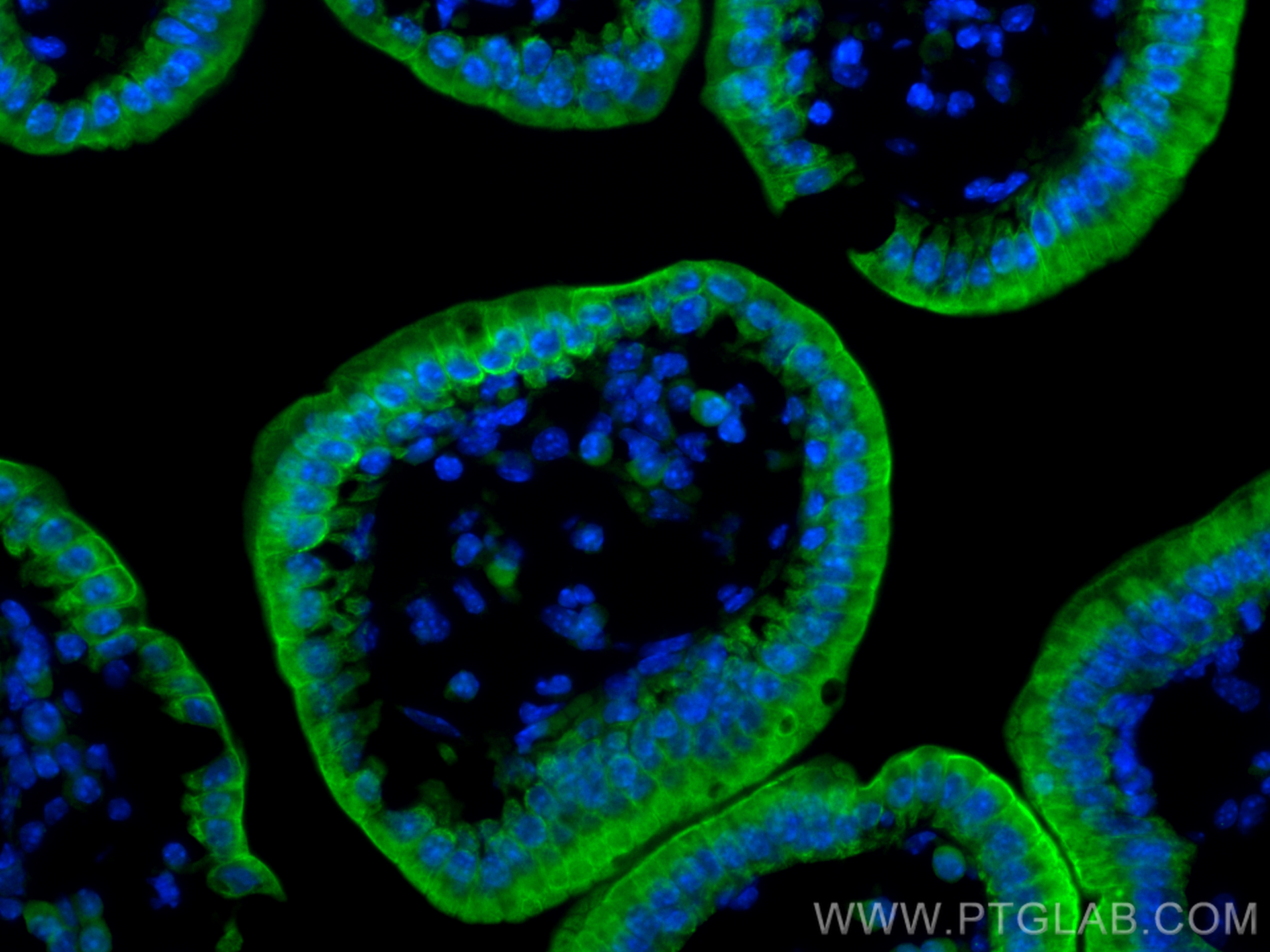 Immunofluorescence (IF) / fluorescent staining of mouse small intestine tissue using CoraLite® Plus 488-conjugated Cytokeratin 19 Polyc (CL488-10712)