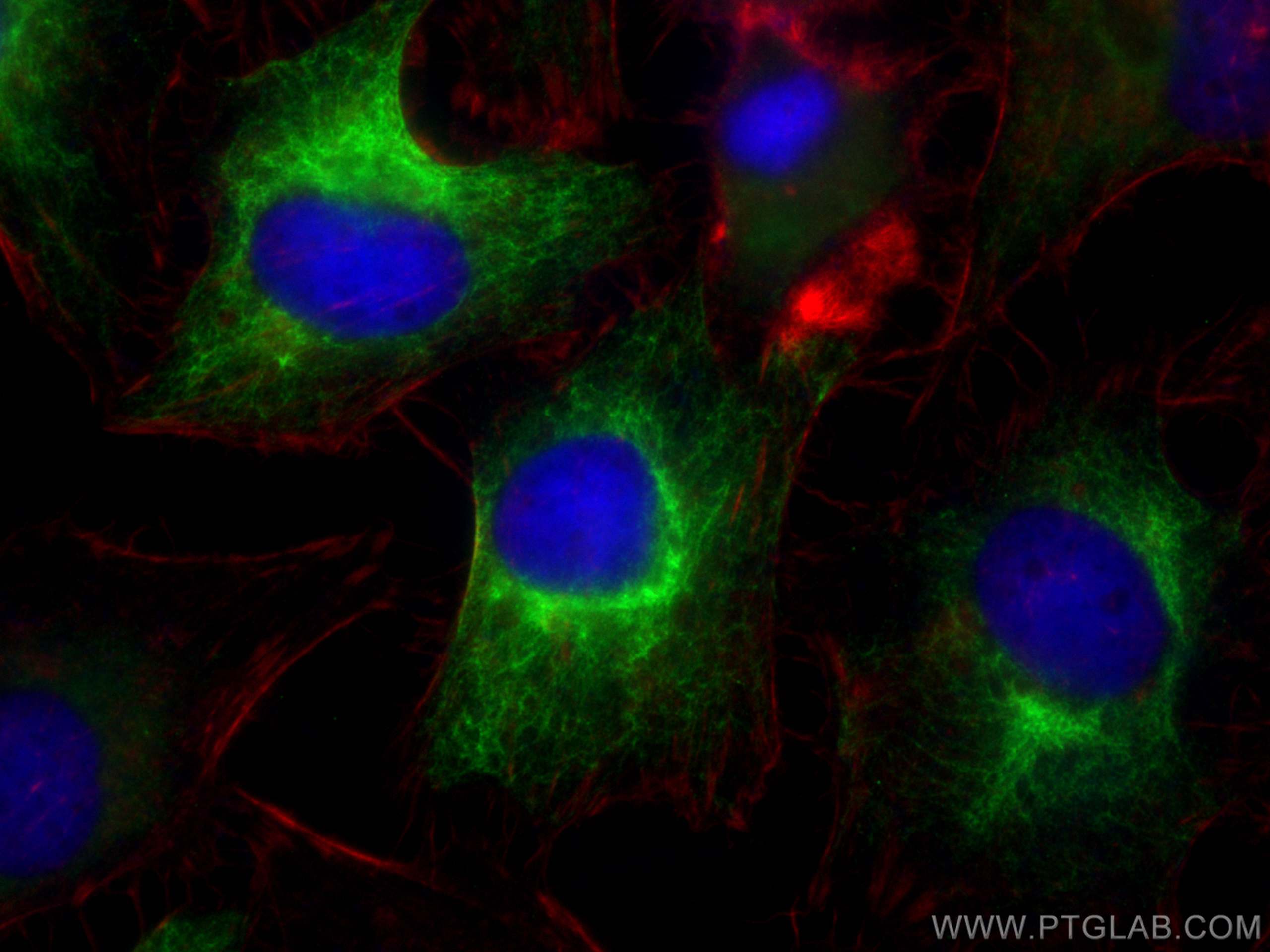 Immunofluorescence (IF) / fluorescent staining of HeLa cells using CoraLite® Plus 488-conjugated Cytokeratin 19 Polyc (CL488-14965)