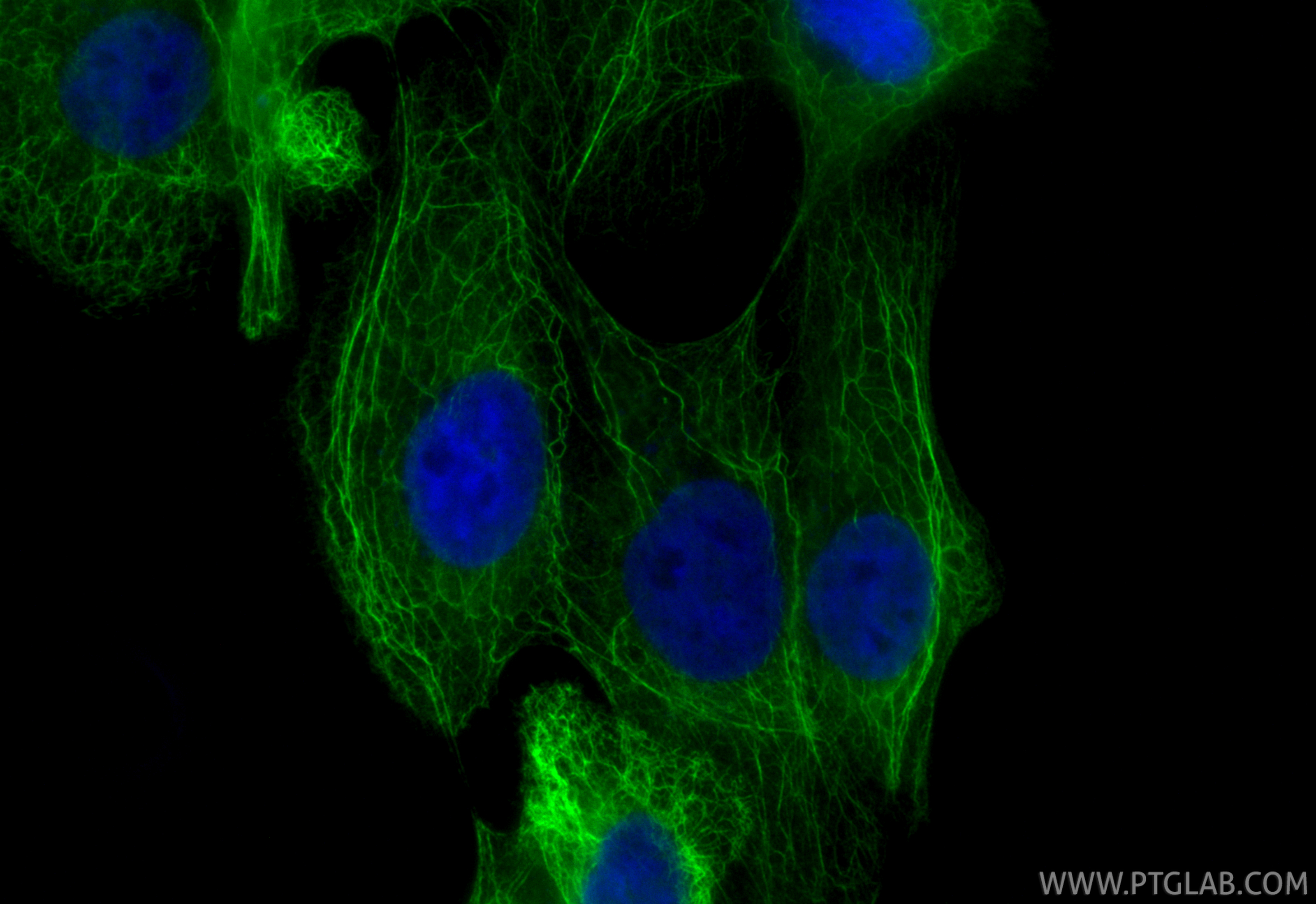Immunofluorescence (IF) / fluorescent staining of A431 cells using Cytokeratin 5 Polyclonal antibody (28506-1-AP)