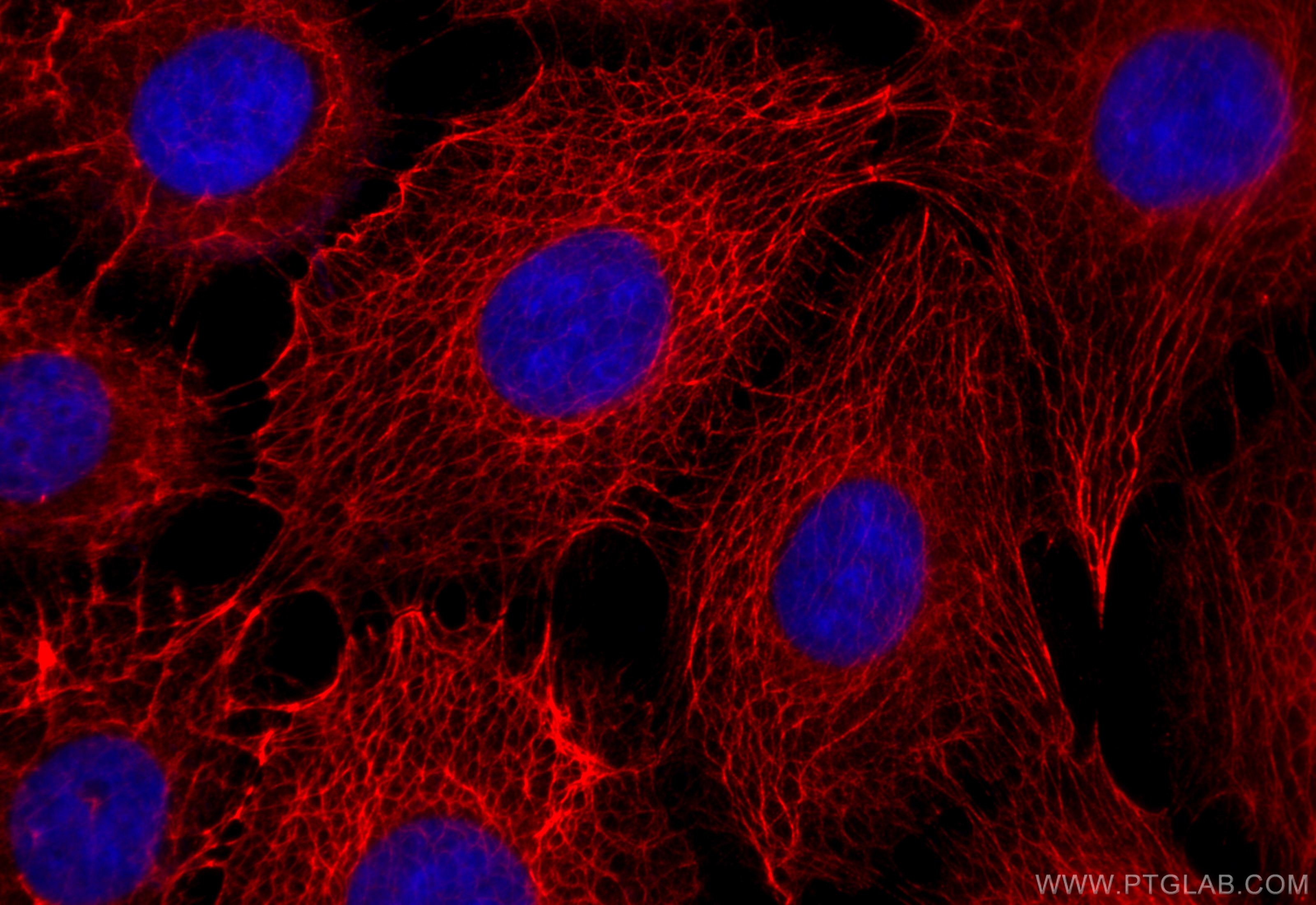 Immunofluorescence (IF) / fluorescent staining of A431 cells using CoraLite®594-conjugated Cytokeratin 5 Polyclonal a (CL594-28506)