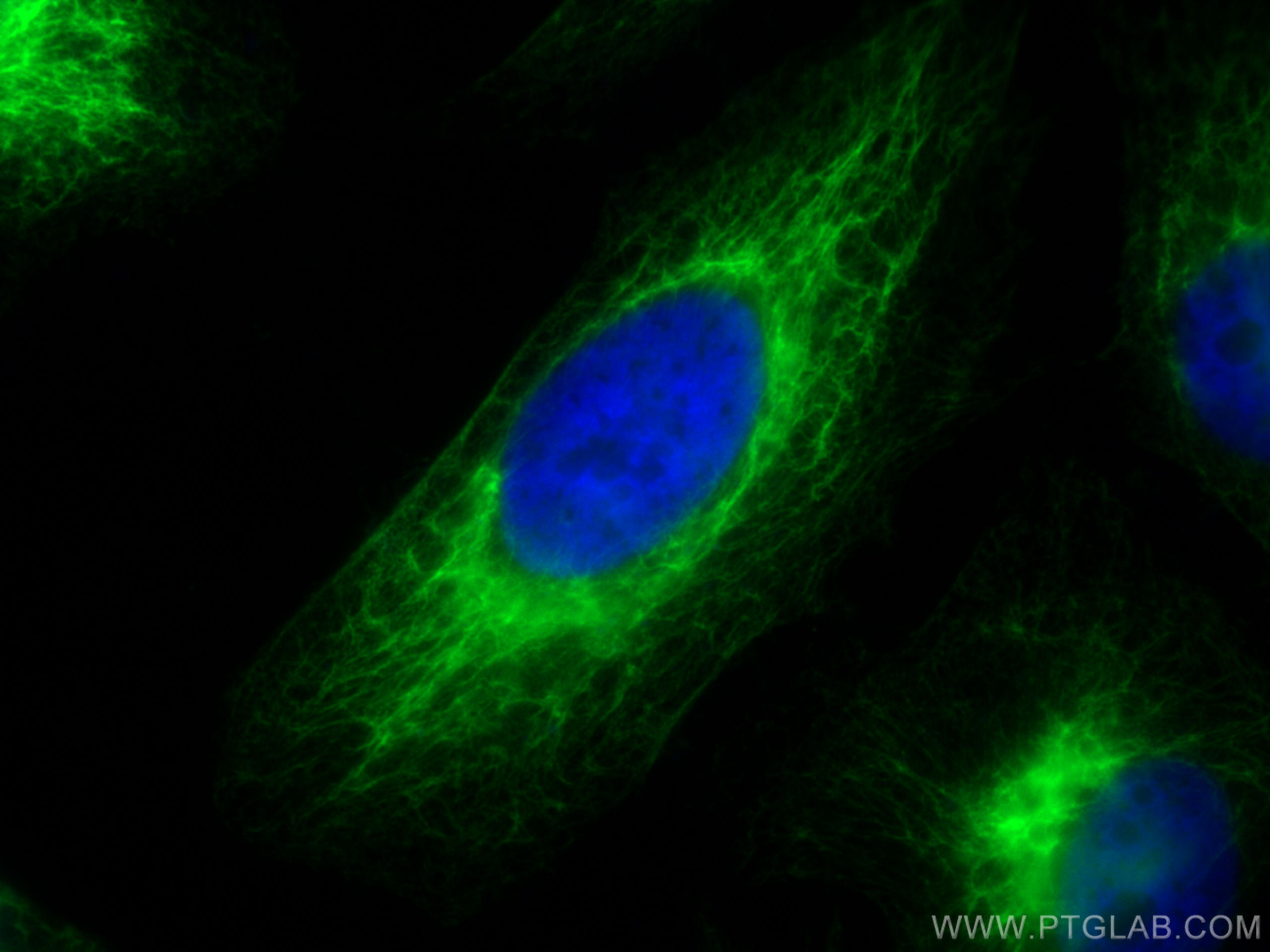 Immunofluorescence (IF) / fluorescent staining of HeLa cells using CoraLite® Plus 488-conjugated Cytokeratin 7 Polycl (CL488-15539)