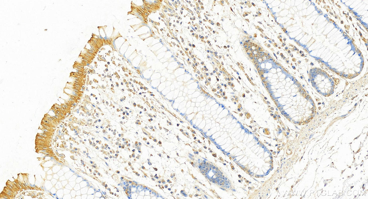 Immunohistochemistry (IHC) staining of human colon tissue using Cytokeratin 8 Monoclonal antibody (68627-1-Ig)