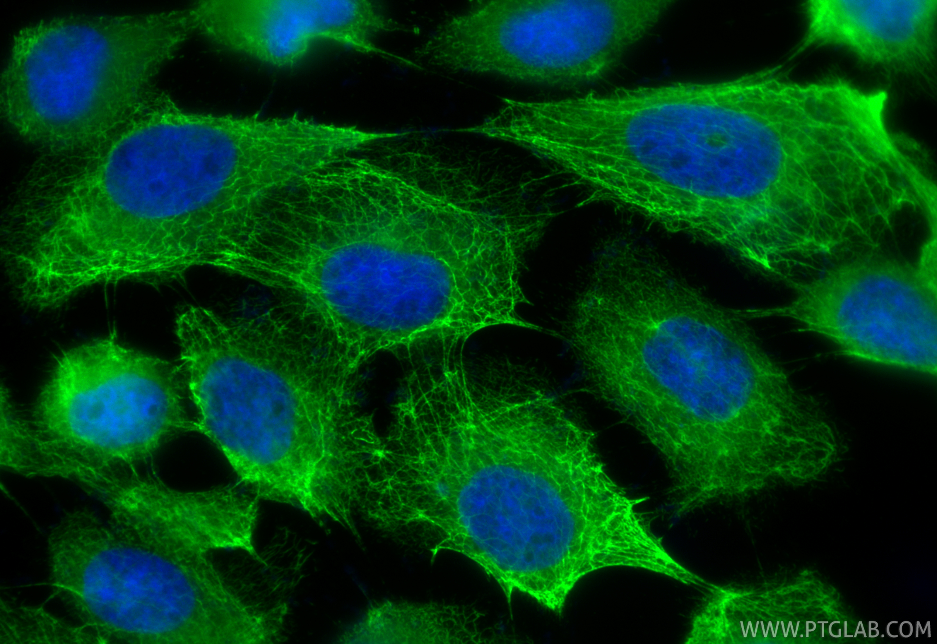 Immunofluorescence (IF) / fluorescent staining of A431 cells using CoraLite® Plus 488-conjugated Cytokeratin 8 Polycl (CL488-10384)