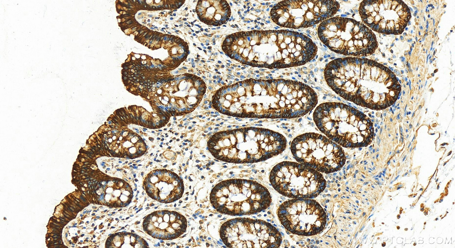 Immunohistochemistry (IHC) staining of human colon tissue using Cytokeratin 8-specific Polyclonal antibody (27105-1-AP)