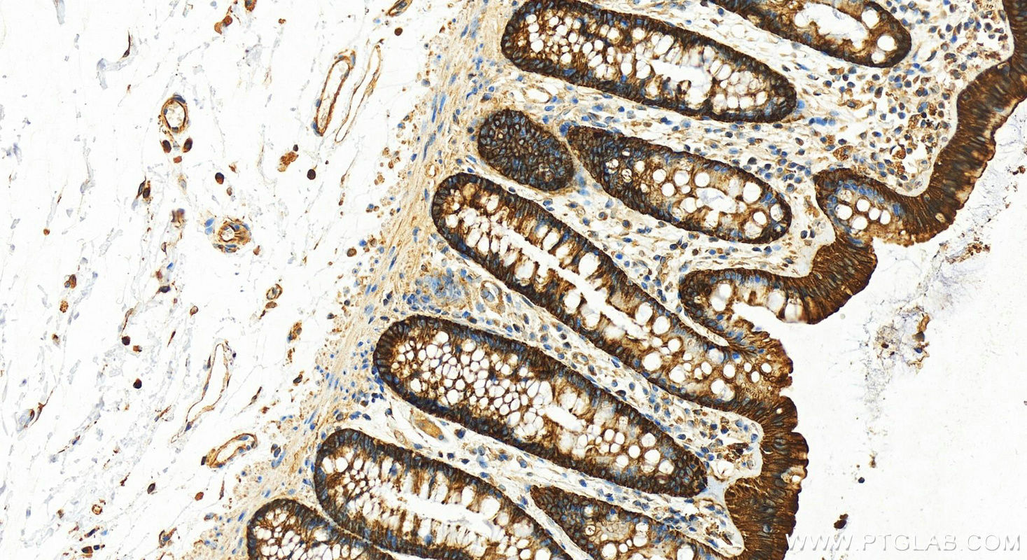 Immunohistochemistry (IHC) staining of human colon tissue using Cytokeratin 8-specific Polyclonal antibody (27105-1-AP)