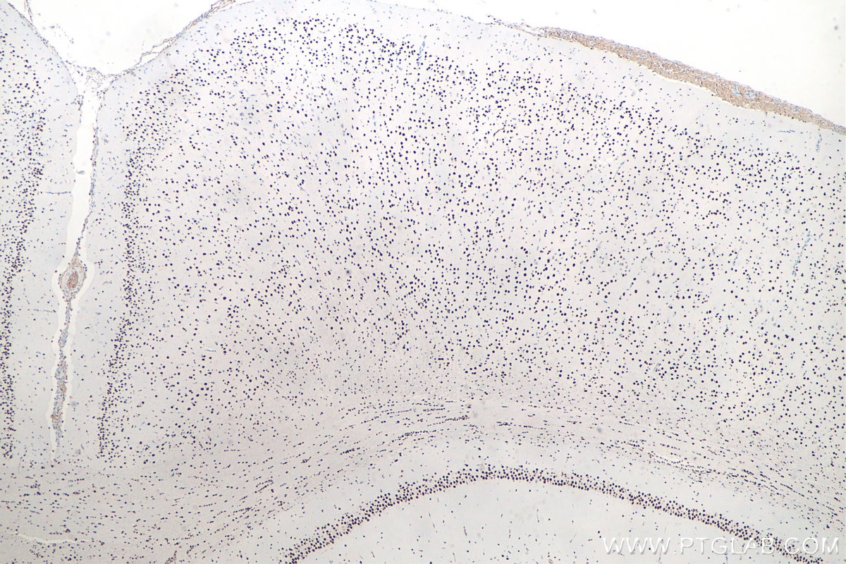 Immunohistochemistry (IHC) staining of rat brain tissue using DACH1 Monoclonal antibody (60082-1-Ig)
