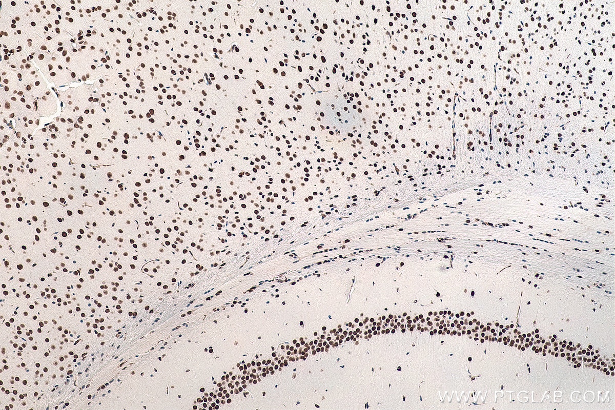 Immunohistochemistry (IHC) staining of mouse brain tissue using DACH1 Monoclonal antibody (60082-1-Ig)