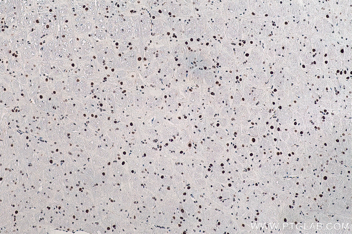 Immunohistochemistry (IHC) staining of rat cerebellum tissue using DACH1 Monoclonal antibody (60082-1-Ig)
