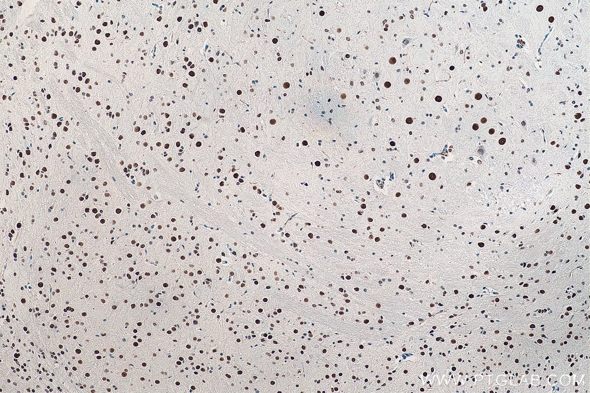 Immunohistochemistry (IHC) staining of mouse cerebellum tissue using DACH1 Monoclonal antibody (60082-1-Ig)