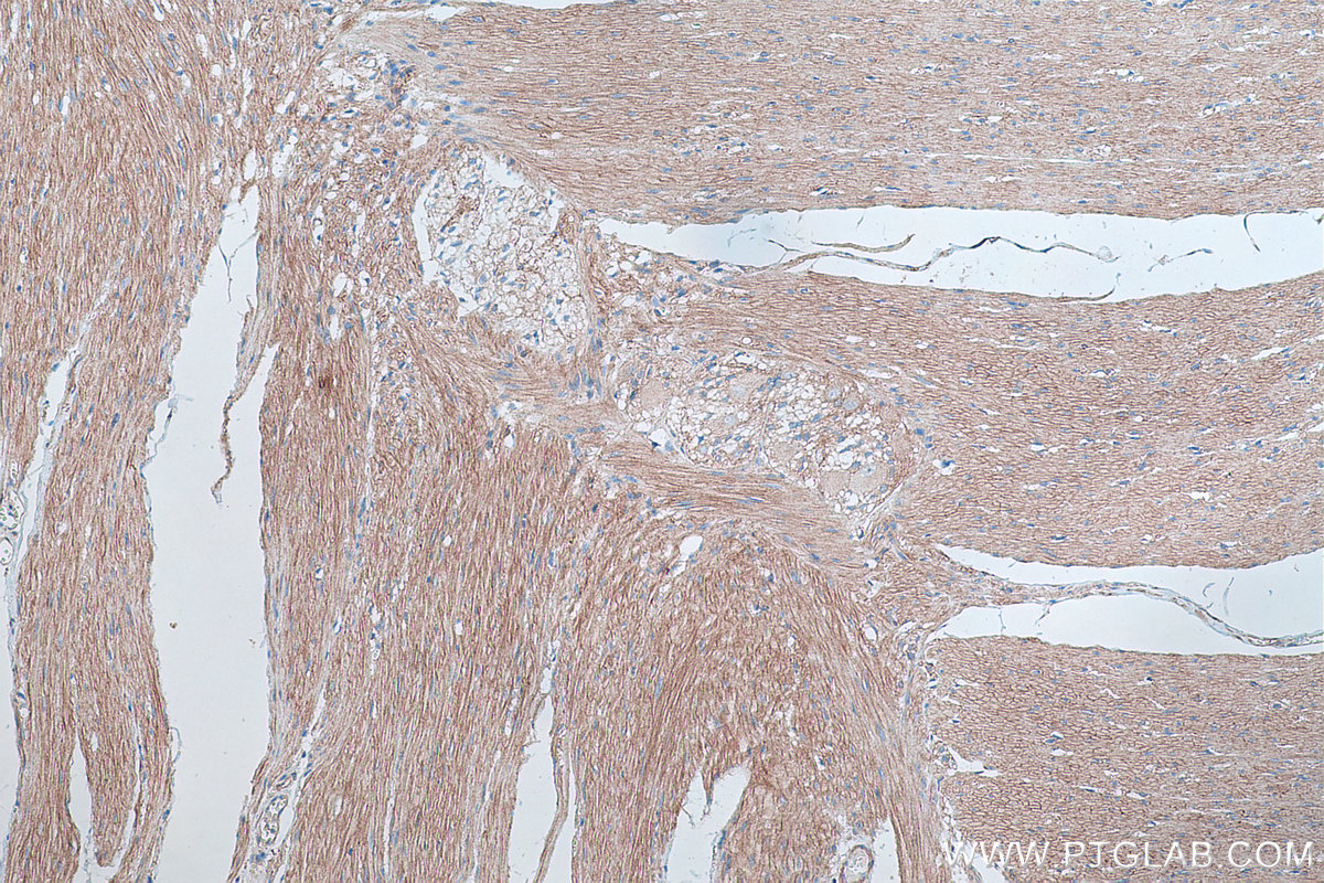 Immunohistochemistry (IHC) staining of human colon tissue using Dystroglycan Monoclonal antibody (66735-1-Ig)