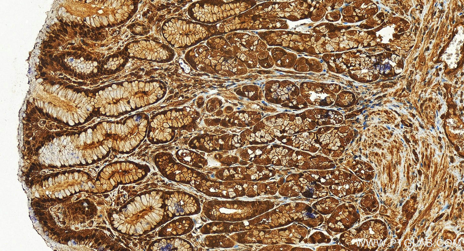 Immunohistochemistry (IHC) staining of human stomach tissue using DAK Polyclonal antibody (12224-1-AP)