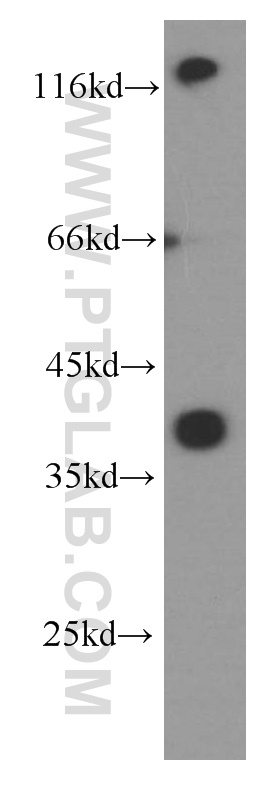 Western Blot (WB) analysis of fetal human brain tissue using DAO Monoclonal antibody (66296-1-Ig)